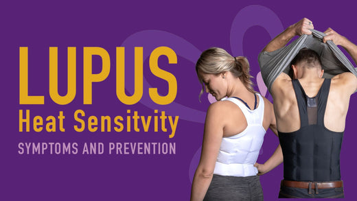 Lupus and Heat Sensitivity